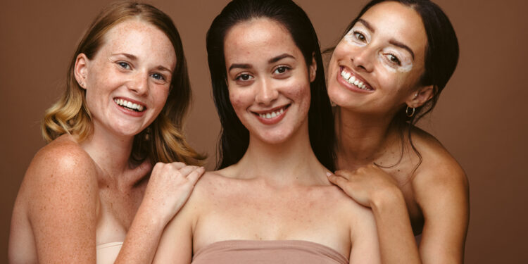 Type of Skin Conditions You Can Occur During Pregnancy