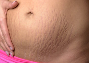 Don’t worry about losing weight after having a baby