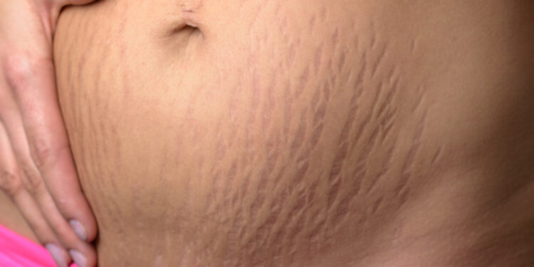 Don’t worry about losing weight after having a baby