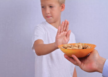What parents should do if their child has food allergies