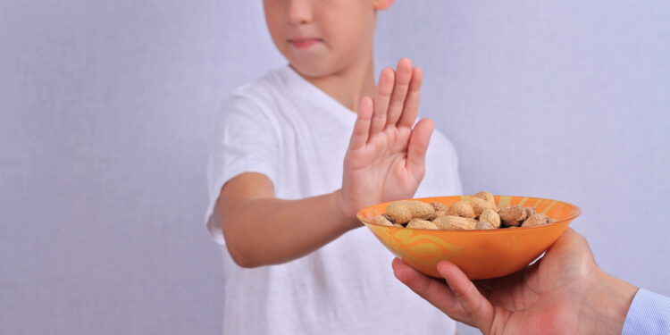 What parents should do if their child has food allergies